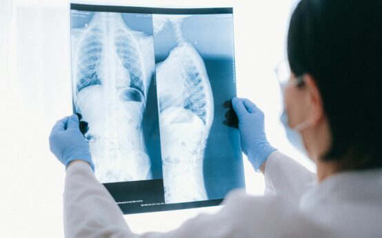 A radiologist analyzing a detailed brain MRI scan enhanced by an AI overlay on a transparent digital screen.